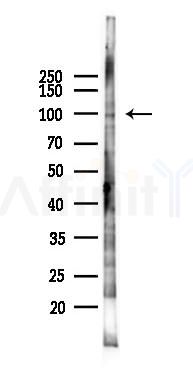 INTS7 Antibody - Western blot analysis of lysates from PC12 cells(LPS 4h treatment), using INTS7 Antibody at 1/1000 dilution.
