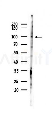 INTS7 Antibody - Western blot analysis of lysates from HUVEC cells(LPS 4h treatment), using INTS7 Antibody at 1/1000 dilution.