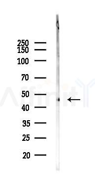 SLC17A3 Antibody - Western blot analysis of lysates from B16F10-LUC cells(heat-shock 45min treatment), using SLC17A3 Antibody at 1/1000 dilution.