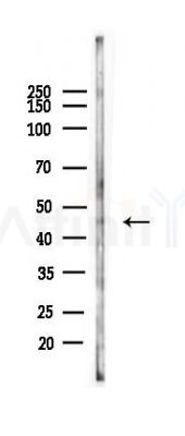 Trim5 alpha Antibody - Western blot analysis of lysates from HUVEC cells(heat-shock 45min treatment), using Trim5 alpha Antibody at 1/1000 dilution.