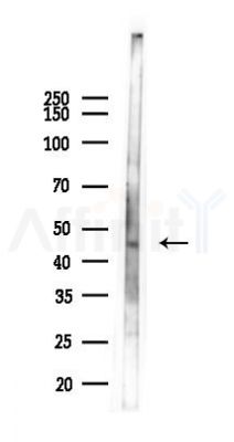 Trim5 alpha Antibody - Western blot analysis of lysates from A2780 cells(LPS 4h treatment), using Trim5 alpha Antibody at 1/1000 dilution.