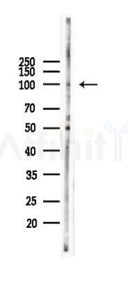 ATF6B Antibody - Western blot analysis of lysates from PC12 cells(LPS 4h treatment), using ATF6B Antibody at 1/1000 dilution.