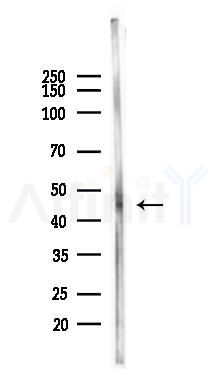 DLX2 Antibody - Western blot analysis of lysates from HUVEC cells(heat-shock 45min treatment), using DLX2 Antibody at 1/1000 dilution.
