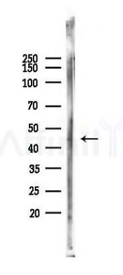 DLX2 Antibody - Western blot analysis of lysates from Rat lung, using DLX2 Antibody at 1/1000 dilution.