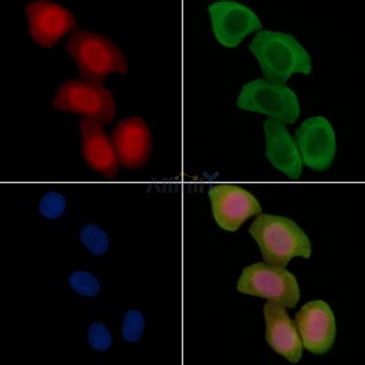 PHKG2 Antibody - DF15580 staining Hela cells(45min of heat-shock treatment) by IF/ICC.