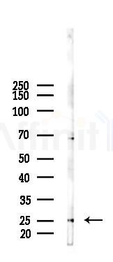 ZNF22 Antibody - Western blot analysis of lysates from B16F10-LUC cells(heat-shock 45min treatment), using ZNF22 Antibody at 1/1000 dilution.