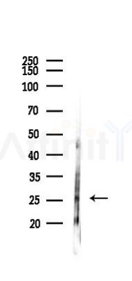 MXI1 Antibody - Western blot analysis of lysates from Rat lung, using MXI1 Antibody at 1/1000 dilution.