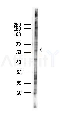 ZNF683 Antibody - Western blot analysis of lysates from PC12 cells(LPS 4h treatment), using ZNF683 Antibody at 1/1000 dilution.