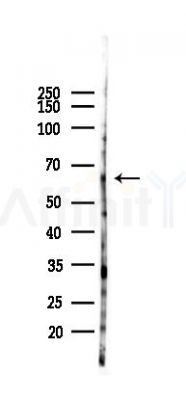 ZNF461 Antibody - Western blot analysis of lysates from HUVEC cells(heat-shock 45min treatment), using ZNF461 Antibody at 1/1000 dilution.