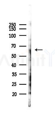ZNF461 Antibody - Western blot analysis of lysates from Rat lung, using ZNF461 Antibody at 1/1000 dilution.
