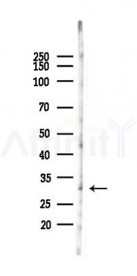 C1QTNF7 Antibody - Western blot analysis of lysates from HUVEC cells(heat-shock 45min treatment), using C1QTNF7 Antibody at 1/1000 dilution.