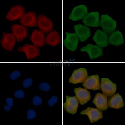 C1QTNF7 Antibody - DF15589 staining Hela cells(45min of heat-shock treatment) by IF/ICC.