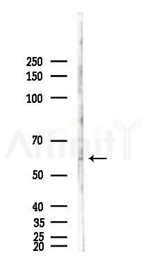CERK Antibody - Western blot analysis of lysates from K562 cells(starvation 24h treatment), using CERK Antibody at 1/1000 dilution.