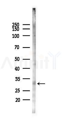 TK2 Antibody - Western blot analysis of lysates from HUVEC cells(heat-shock 45min treatment), using TK2 Antibody at 1/1000 dilution.