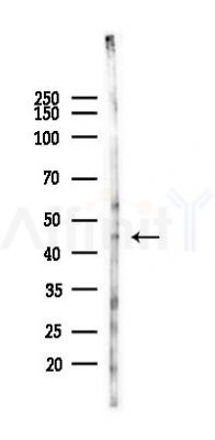 PIGK Antibody - Western blot analysis of lysates from HUVEC cells(heat-shock 45min treatment), using PIGK Antibody at 1/1000 dilution.