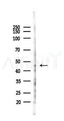 GPBP1 Antibody - Western blot analysis of lysates from HUVEC cells(heat-shock 45min treatment), using GPBP1 Antibody at 1/1000 dilution.