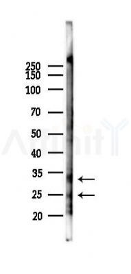 MEAF6 Antibody - Western blot analysis of lysates from Rat lung, using MEAF6 Antibody at 1/1000 dilution.