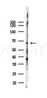 SPPL2B Antibody - Western blot analysis of lysates from A2780 cells(LPS 4h treatment), using SPPL2B Antibody at 1/1000 dilution.