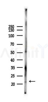 Rab25 Antibody - Western blot analysis of lysates from Rat lung, using Rab25 Antibody at 1/1000 dilution.