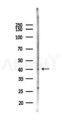 RNF34 Antibody - Western blot analysis of lysates from A2780 cells(LPS 4h treatment), using RNF34 Antibody at 1/1000 dilution.