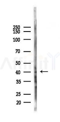 RNF34 Antibody - Western blot analysis of lysates from Mouse lung, using RNF34 Antibody at 1/1000 dilution.