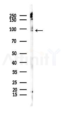 DCAF6 Antibody - Western blot analysis of lysates from Rat testis, using DCAF6 Antibody at 1/1000 dilution.
