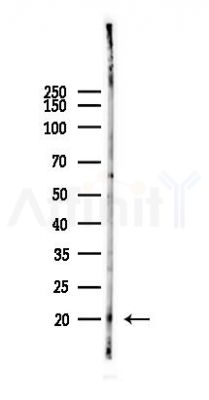 GIP Antibody - Western blot analysis of lysates from Rat lung, using GIP Antibody at 1/1000 dilution.