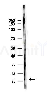 SSX2; SSX2B Antibody - Western blot analysis of lysates from HUVEC cells(heat-shock 45min treatment), using SSX2; SSX2B Antibody at 1/1000 dilution.