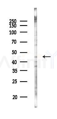 ALX4 Antibody - Western blot analysis of lysates from K562 cells(UV 30min treatment), using ALX4 Antibody at 1/1000 dilution.