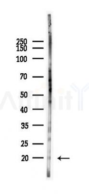 RGS16 Antibody - Western blot analysis of lysates from HUVEC cells(heat-shock 45min treatment), using RGS16 Antibody at 1/1000 dilution.
