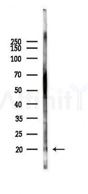 RGS16 Antibody - Western blot analysis of lysates from Rat lung, using RGS16 Antibody at 1/1000 dilution.
