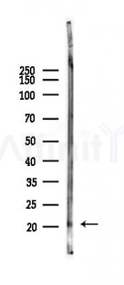 RAP2A Antibody - Western blot analysis of lysates from Rat lung, using RAP2A Antibody at 1/1000 dilution.