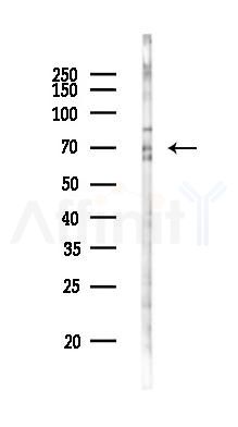 GRHL3 Antibody - Western blot analysis of lysates from K562 cells(UV 30min treatment), using GRHL3 Antibody at 1/1000 dilution.