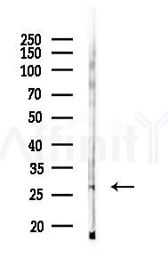 EXOSC6 Antibody - Western blot analysis of lysates from Mouse lung, using EXOSC6 Antibody at 1/1000 dilution.