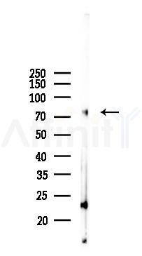 ZNF16 Antibody - Western blot analysis of lysates from Mouse lung, using ZNF16 Antibody at 1/1000 dilution.