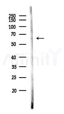 ZNF382 Antibody - Western blot analysis of lysates from Hela cells(heat-shock 45min treatment), using ZNF382 Antibody at 1/1000 dilution.