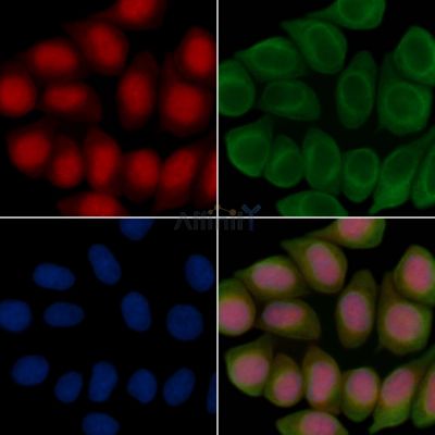 ZNF382 Antibody - DF15647 staining Hela cells(45min of heat-shock treatment) by IF/ICC.