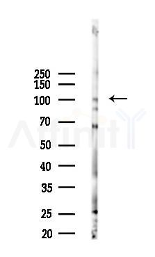 ECT2 Antibody - Western blot analysis of lysates from B16F10-LUC cells(heat-shock 45min treatment), using ECT2 Antibody at 1/1000 dilution.