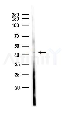TRABD Antibody - Western blot analysis of lysates from Hela cells(heat-shock 45min treatment), using TRABD Antibody at 1/1000 dilution.
