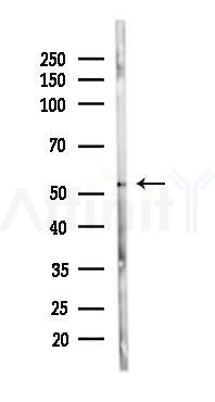 GPHRA/B Antibody - Western blot analysis of lysates from 293 cells(heat-shock 45min treatment), using GPHRA/B Antibody at 1/1000 dilution.