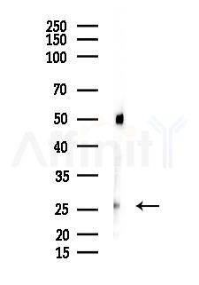 MOSPD3 Antibody - Western blot analysis of lysates from Rat lung, using MOSPD3 Antibody at 1/1000 dilution.