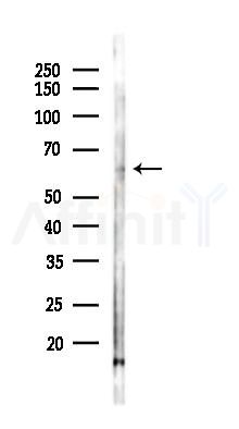 SLC15A4 Antibody - Western blot analysis of lysates from Rat lung, using SLC15A4 Antibody at 1/1000 dilution.
