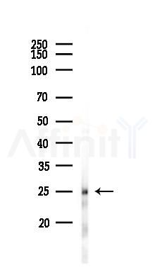 EPX Antibody - Western blot analysis of lysates from Hela cells(heat-shock 45min treatment), using EPX Antibody at 1/1000 dilution.