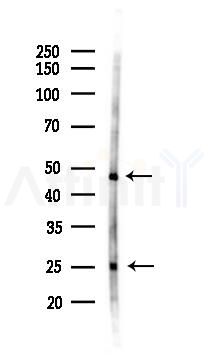 EPX Antibody - Western blot analysis of lysates from Rat lung, using EPX Antibody at 1/1000 dilution.