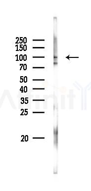 VWF Antibody - Western blot analysis of lysates from PC12 cells(LPS 4h treatment), using VWF Antibody at 1/1000 dilution.