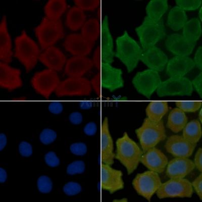 FBXL20 Antibody - DF15694 staining Hela cells(30min of UV treatment) by IF/ICC.
