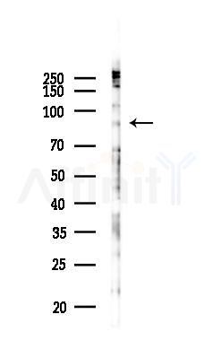 SLITRK1 Antibody - Western blot analysis of lysates from B16F10-LUC cells(heat-shock 45min treatment), using SLITRK1 Antibody at 1/1000 dilution.
