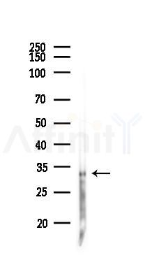 RIMS3 Antibody - Western blot analysis of lysates from Hela cells(heat-shock 45min treatment), using RIMS3 Antibody at 1/1000 dilution.