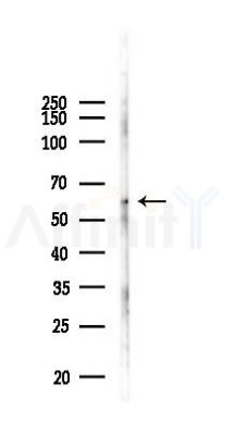 FAR2 Antibody - Western blot analysis of lysates from B16F10-LUC cells(heat-shock 45min treatment), using FAR2 Antibody at 1/1000 dilution.