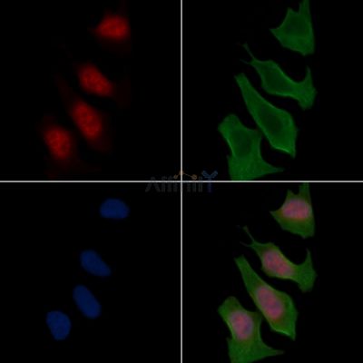 SF3A1 Antibody - DF15704 staining Hela cells(30min of UV treatment) by IF/ICC.